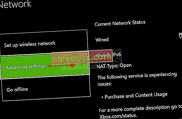 Pokročilé nastavení sítě pro Xbox One